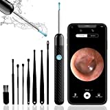 Ear Wax Removal, Ear Cleaner with Camera, Ear Wax Removal Tool with 1080P, Ear Camera Otoscope with Light, Ear Wax Removal kit for iPhone, iPad, Android Phones